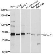 SLC7A1 / CAT1 Antibody - Western blot analysis of extracts of various cell lines, using SLC7A1 antibody at 1:1000 dilution. The secondary antibody used was an HRP Goat Anti-Rabbit IgG (H+L) at 1:10000 dilution. Lysates were loaded 25ug per lane and 3% nonfat dry milk in TBST was used for blocking. An ECL Kit was used for detection and the exposure time was 60s.