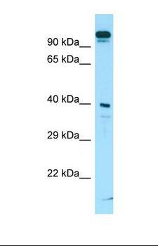 SLC7A10 / Asc-1 Antibody - Western blot of Human ACHN. SLC7A10 antibody dilution 1.0 ug/ml.  This image was taken for the unconjugated form of this product. Other forms have not been tested.