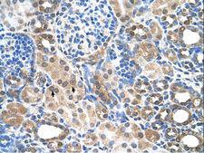 SLC7A14 Antibody - SLC7A14 antibody ARP44014_T100-NP_066000-SLC7A14(solute carrier family 7 (cationic amino acid transporter, y+ system), member 14) Antibody was used in IHC to stain formalin-fixed, paraffin-embedded human kidney.  This image was taken for the unconjugated form of this product. Other forms have not been tested.