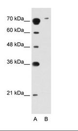 SLC7A14 Antibody - A: Marker, B: Jurkat Cell Lysate.  This image was taken for the unconjugated form of this product. Other forms have not been tested.