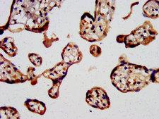 SLC7A2 Antibody - Immunohistochemistry image at a dilution of 1:400 and staining in paraffin-embedded human placenta tissue performed on a Leica BondTM system.