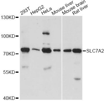 SLC7A2 Antibody - Western blot analysis of extracts of various cell lines, using SLC7A2 antibody at 1:1000 dilution. The secondary antibody used was an HRP Goat Anti-Rabbit IgG (H+L) at 1:10000 dilution. Lysates were loaded 25ug per lane and 3% nonfat dry milk in TBST was used for blocking. An ECL Kit was used for detection and the exposure time was 90s.
