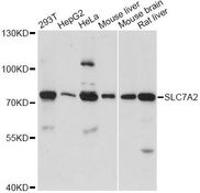 SLC7A2 Antibody - Western blot analysis of extracts of various cell lines, using SLC7A2 antibody at 1:1000 dilution. The secondary antibody used was an HRP Goat Anti-Rabbit IgG (H+L) at 1:10000 dilution. Lysates were loaded 25ug per lane and 3% nonfat dry milk in TBST was used for blocking. An ECL Kit was used for detection and the exposure time was 90s.