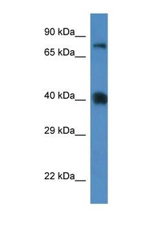 SLC7A3 / CAT-3 Antibody - SLC7A3 antibody Western blot of Mouse Spleen lysate. Antibody concentration 1 ug/ml. This image was taken for the unconjugated form of this product. Other forms have not been tested.