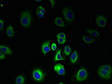 SLC7A3 / CAT-3 Antibody - Immunofluorescent analysis of MCF-7 cells using SLC7A3 Antibody at dilution of 1:100 and Alexa Fluor 488-congugated AffiniPure Goat Anti-Rabbit IgG(H+L)