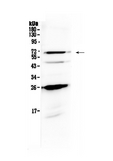 SLC7A3 / CAT-3 Antibody - Western blot analysis of SLC7A3 using anti-SLC7A3 antibody. Electrophoresis was performed on a 5-20% SDS-PAGE gel at 70V (Stacking gel) / 90V (Resolving gel) for 2-3 hours. The sample well of each lane was loaded with 50ug of sample under reducing conditions. Lane 1: human A431 whole cell lysate. After Electrophoresis, proteins were transferred to a Nitrocellulose membrane at 150mA for 50-90 minutes. Blocked the membrane with 5% Non-fat Milk/ TBS for 1.5 hour at RT. The membrane was incubated with rabbit anti-SLC7A3 antigen affinity purified polyclonal antibody at 0.5 µg/mL overnight at 4°C, then washed with TBS-0.1% Tween 3 times with 5 minutes each and probed with a goat anti-rabbit IgG-HRP secondary antibody at a dilution of 1:10000 for 1.5 hour at RT. The signal is developed using an Enhanced Chemiluminescent detection (ECL) kit with Tanon 5200 system. A specific band was detected for SLC7A3 at approximately 67KD. The expected band size for SLC7A3 is at 67KD.