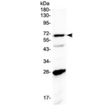 SLC7A3 / CAT-3 Antibody - Western blot testing of human A431 cell lysate with SLC7A3 antibody at 0.5ug/ml. Predicted molecular weight ~67 kDa.