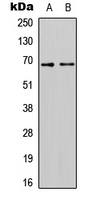 SLC7A4 Antibody - Western blot analysis of CAT4 expression in HEK293T (A); HepG2 (B) whole cell lysates.