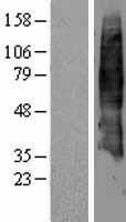 SLC7A4 Protein - Western validation with an anti-DDK antibody * L: Control HEK293 lysate R: Over-expression lysate