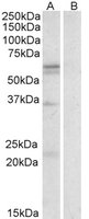 SLC7A5 / CD98 Light Chain Antibody - SLC7A5 antibody (0.3 ug/ml) staining of Human Spleen lysate (35 ug protein/ml in RIPA buffer) with (B) and without (A) blocking with the immunizing peptide. Primary incubation was 1 hour. Detected by chemiluminescence.