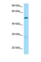 SLC7A5 / CD98 Light Chain Antibody - SLC7A5 antibody Western blot of Jurkat Cell lysate. Antibody concentration 1 ug/ml.  This image was taken for the unconjugated form of this product. Other forms have not been tested.