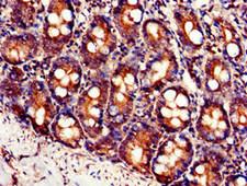 SLC7A6 Antibody - Immunohistochemistry image of paraffin-embedded human small intestine tissue at a dilution of 1:100