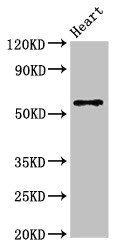 SLC7A6 Antibody - Positive Western Blot detected in Mouse heart tissue. All lanes: SLC7A6 antibody at 3 µg/ml Secondary Goat polyclonal to rabbit IgG at 1/50000 dilution. Predicted band size: 57 KDa. Observed band size: 57 KDa