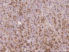 SLC7A6OS Antibody - Immunochemical staining of human SLC7A6OS in human adrenal gland with rabbit polyclonal antibody at 1:1000 dilution, formalin-fixed paraffin embedded sections.