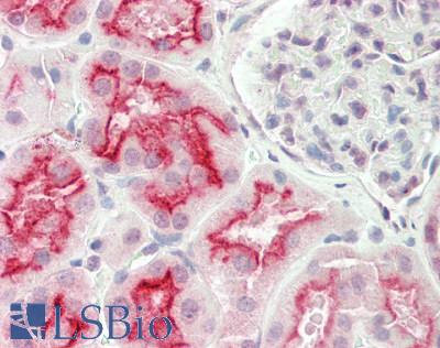 SLC7A7 Antibody - Human Kidney: Formalin-Fixed, Paraffin-Embedded (FFPE).  This image was taken for the unconjugated form of this product. Other forms have not been tested.