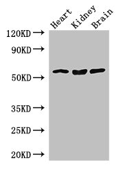 SLC7A7 Antibody - Western Blot Positive WB detected in: Mouse heart tissue, Mouse kidney tissue, Mouse brain tissue All lanes: SLC7A7 antibody at 3.5µg/ml Secondary Goat polyclonal to rabbit IgG at 1/50000 dilution Predicted band size: 56 kDa Observed band size: 56 kDa