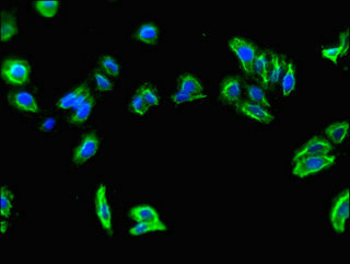SLC7A7 Antibody - Immunofluorescent analysis of HepG2 cells using SLC7A7 Antibody at dilution of 1:100 and Alexa Fluor 488-congugated AffiniPure Goat Anti-Rabbit IgG(H+L)