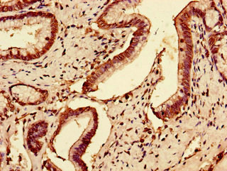 SLC7A7 Antibody - Immunohistochemistry of paraffin-embedded human pancreatic tissue using SLC7A7 Antibody at dilution of 1:100