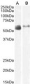SLC7A7 Antibody - Antibody (2µg/ml) staining of Human Lung (A) and Skeletal Muscle (B) lysate (35µg protein in RIPA buffer). Primary incubation was 1 hour. Detected by chemiluminescence
