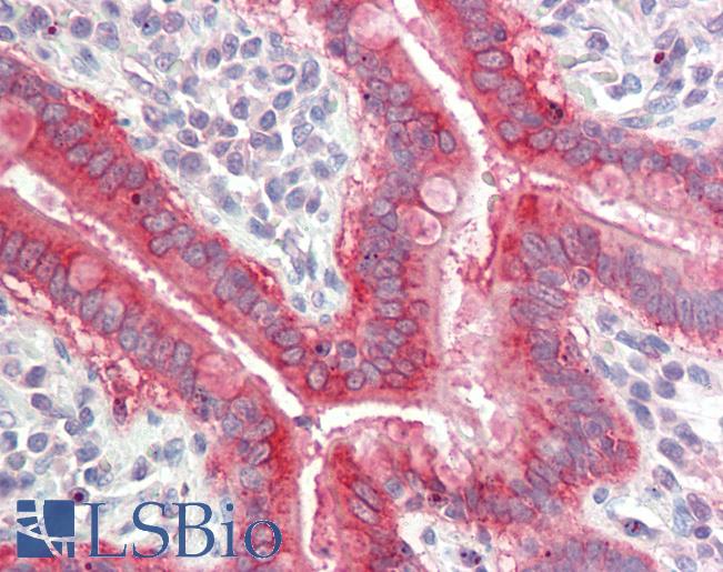 SLC7A8 / LAT2 Antibody - Anti-SLC7A8 / LAT2 antibody IHC staining of human small intestine. Immunohistochemistry of formalin-fixed, paraffin-embedded tissue after heat-induced antigen retrieval. Antibody concentration 10 ug/ml.  This image was taken for the unconjugated form of this product. Other forms have not been tested.