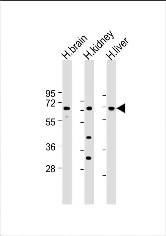 SLC7A8 / LAT2 Antibody - All lanes: Anti-SLC7A8 Antibody (C-Term) at 1:1000-1:2000 dilution Lane 1: Human brain lysate Lane 2: Human kidney lysate Lane 3: Human liver lysate Lysates/proteins at 20 µg per lane. Secondary Goat Anti-Rabbit IgG, (H+L), Peroxidase conjugated at 1/10000 dilution. Predicted band size: 58 kDa Blocking/Dilution buffer: 5% NFDM/TBST.