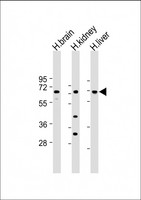 SLC7A8 / LAT2 Antibody - All lanes: Anti-SLC7A8 Antibody (C-Term) at 1:1000-1:2000 dilution Lane 1: Human brain lysate Lane 2: Human kidney lysate Lane 3: Human liver lysate Lysates/proteins at 20 µg per lane. Secondary Goat Anti-Rabbit IgG, (H+L), Peroxidase conjugated at 1/10000 dilution. Predicted band size: 58 kDa Blocking/Dilution buffer: 5% NFDM/TBST.