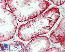 SLC7A8 / LAT2 Antibody - Human Kidney: Formalin-Fixed, Paraffin-Embedded (FFPE)