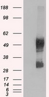 SLC7A8 / LAT2 Antibody - HEK293T cells were transfected with the pCMV6-ENTRY control (Left lane) or pCMV6-ENTRY SLC7A8 (Right lane) cDNA for 48 hrs and lysed. Equivalent amounts of cell lysates (5 ug per lane) were separated by SDS-PAGE and immunoblotted with anti-SLC7A8.
