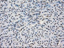 SLC7A8 / LAT2 Antibody - IHC of paraffin-embedded endometrium tissue using anti-SLC7A8 mouse monoclonal antibody. (Dilution 1:50).