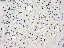 SLC7A8 / LAT2 Antibody - IHC of paraffin-embedded prostate tissue using anti-SLC7A8 mouse monoclonal antibody. (Dilution 1:50).