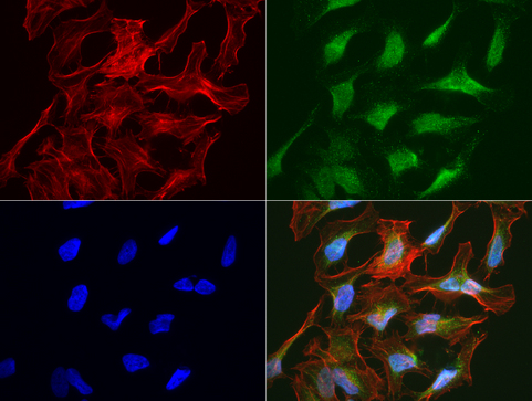 SLC7A8 / LAT2 Antibody - Immunofluorescent staining of HeLa cells using anti-SLC7A8 mouse monoclonal antibody  green, 1:50). Actin filaments were labeled with Alexa Fluor® 594 Phalloidin. (red), and nuclear with DAPI. (blue).