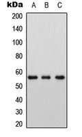 SLC7A8 / LAT2 Antibody - Western blot analysis of LAT2 expression in HEK293T (A); Raw264.7 (B); PC12 (C) whole cell lysates.