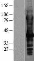SLC7A8 / LAT2 Protein - Western validation with an anti-DDK antibody * L: Control HEK293 lysate R: Over-expression lysate