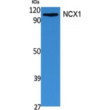 SLC8A1 / NCX1 Antibody - Western blot of NCX1 antibody