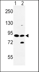 SLC8A1 / NCX1 Antibody - Western blot of SLC8A1 Antibody in HL-60(lane 1), K562(lane 2) cell line lysates (35 ug/lane). SLC8A1 (arrow) was detected using the purified antibody.