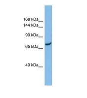 SLC8A1 / NCX1 Antibody - Western blot of Human ACHN. SLC8A1 antibody dilution 1.0 ug/ml.  This image was taken for the unconjugated form of this product. Other forms have not been tested.