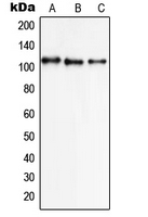 SLC8A1 / NCX1 Antibody - Western blot analysis of NCX1 expression in K562 (A); A549 (B); HL60 (C) whole cell lysates.
