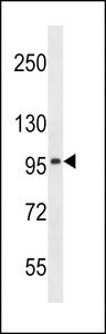 SLC8A3 / NCX3 Antibody - SLC8A3 Antibody western blot of NCI-H460 cell line lysates (35 ug/lane). The SLC8A3 antibody detected the SLC8A3 protein (arrow).