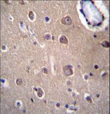 SLC8A3 / NCX3 Antibody - SLC8A3 Antibody immunohistochemistry of formalin-fixed and paraffin-embedded human brain tissue followed by peroxidase-conjugated secondary antibody and DAB staining.