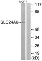 SLC8B1 / SLC24A6 / NCLX Antibody - Western blot analysis of lysates from MCF-7 cells, using SLC24A6 Antibody. The lane on the right is blocked with the synthesized peptide.