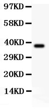 SLC9A1 / NHE1 Antibody - SLC9A1 antibody Western blot. All lanes: Anti SLC9A1 at 0.5 ug/ml. WB: Recombinant Human Sodium Protein 0.5ng. Predicted band size: 37 kD. Observed band size: 37 kD.
