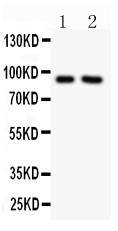 SLC9A1 / NHE1 Antibody - SLC9A1 antibody Western blot. All lanes: Anti SLC9A1 at 0.5 ug/ml. Lane 1: PC-12 Whole Cell Lysate at 40 ug. Lane 2: MCF-7 Whole Cell Lysate at 40 ug. Predicted band size: 91 kD. Observed band size: 91 kD.