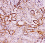 SLC9A1 / NHE1 Antibody - SLC9A1 antibody IHC-paraffin: Rat Kidney Tissue.