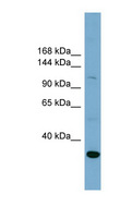 SLC9A1 / NHE1 Antibody - SLC9A1 antibody Western blot of PANC1 cell lysate. This image was taken for the unconjugated form of this product. Other forms have not been tested.