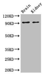 SLC9A1 / NHE1 Antibody - Positive WB detected in:Mouse brain tissue,Mouse kidney tissue;All lanes: SLC9A1 antibody at 3ug/ml;Secondary;Goat polyclonal to rabbit IgG at 1/50000 dilution;Predicted band size: 91,62 kDa;Observed band size: 91 kDa;