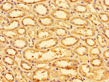 SLC9A1 / NHE1 Antibody - Immunohistochemistry of paraffin-embedded human renal tissue using SLC9A1 Antibody at dilution of 1:100