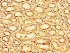 SLC9A1 / NHE1 Antibody - Immunohistochemistry of paraffin-embedded human renal tissue using SLC9A1 Antibody at dilution of 1:100