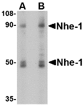 SLC9A1 / NHE1 Antibody - Western blot analysis of Nhe-1 in MOLT4 cell lysate with in with Nhe-1 antibody at (A) 1 and (B) 2 ug/mL.