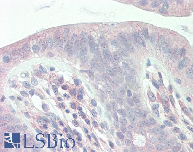 SLC9A1BP / CHP Antibody - Anti-SLC9A1BP / CHP antibody IHC staining of human colon. Immunohistochemistry of formalin-fixed, paraffin-embedded tissue after heat-induced antigen retrieval. Antibody concentration 10 ug/ml.  This image was taken for the unconjugated form of this product. Other forms have not been tested.