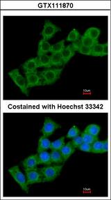 SLC9A1BP / CHP Antibody - Immunofluorescence of methanol-fixed HepG2 using Calcium binding protein P22 antibody at 1:200 dilution.